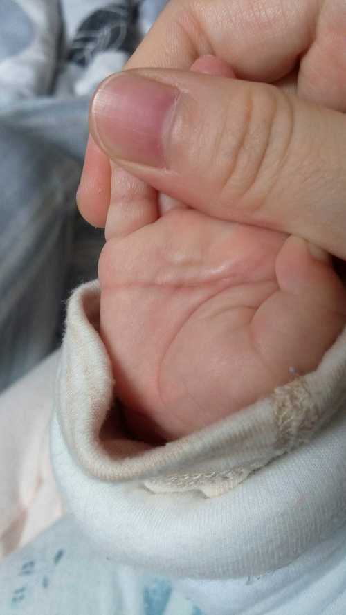 关于宝宝奇怪的手掌掌纹,宝妈们请帮我看看.