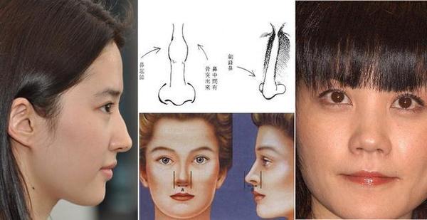 鼻子面相分为三段,两眼中间鼻梁部分名为「山根」意思为人命运的基础